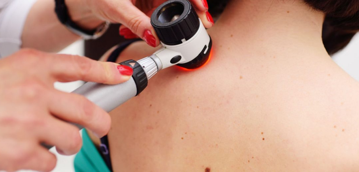 CZERNIAK - CHARAKTERYSTYKA - CZYNNIKI RYZYKA - PROFILAKTYKA