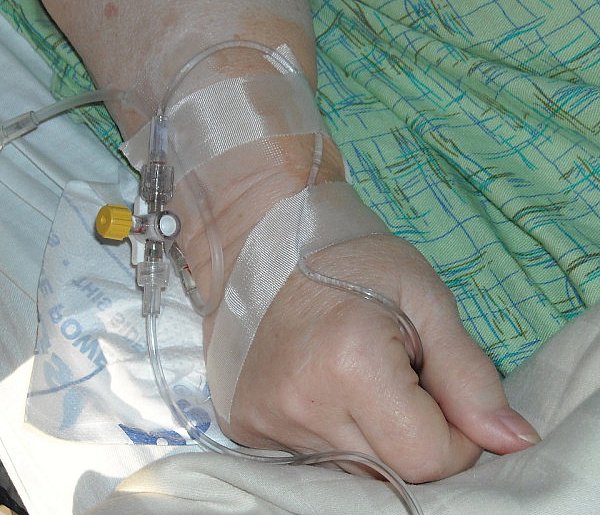 Pacjenci apelują o zmiany. Chodzi o dostęp do nowoczesnych terapii-100224