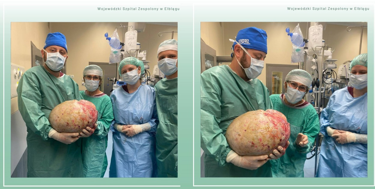 Foto: Wojewódzki Szpital Zespolony w Elblągu